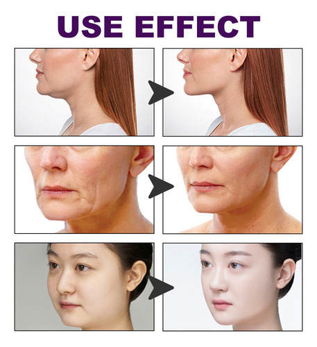 H V Parche De Lifting Facial Que Da Forma A La Cara, Levanta