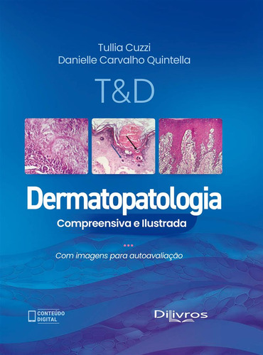 T & D Dermatopatologia Compreensiva Ilustrada, 1ª Edição 2025