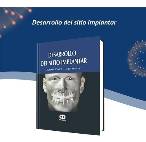 Desarrollo Del Sitio Implantar Sonick,jk