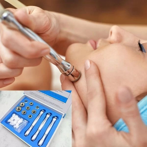 Imagen 3 de 6 de Microdermoabrasión Facial 3 En 1
