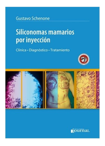Siliconomas Mamarios Por Inyección - Outlet