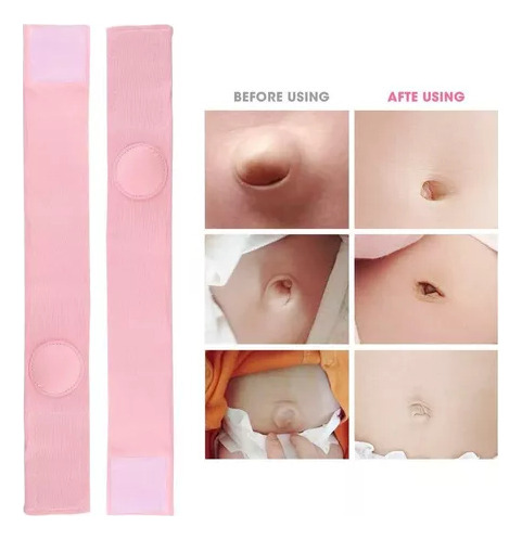 Faixa Umbilical Belly B, Cinto De Hérnia De Umbigo Para Bebê
