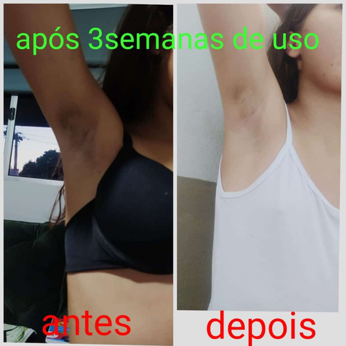Clareador Virilha Suvaco Axila Creme Firmador De Bumbum Kit