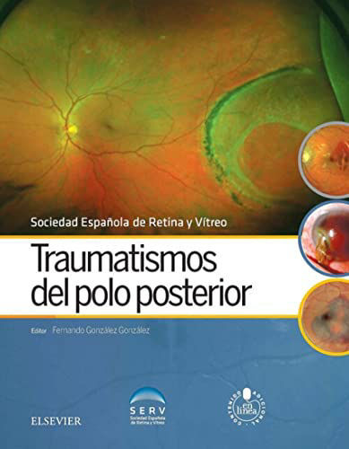 Traumatismos Del Polo Posterior + Acceso Web © 2016