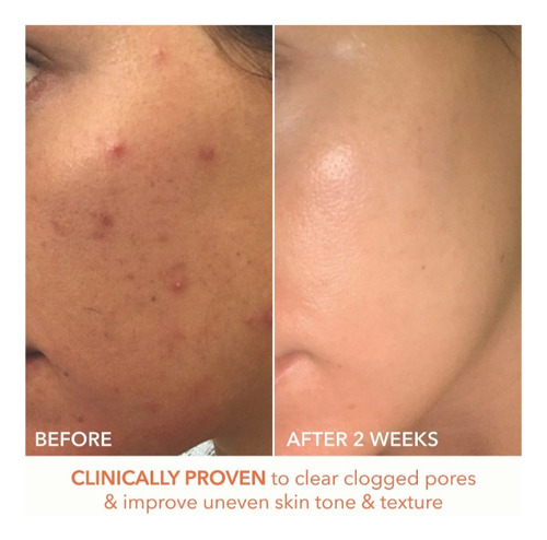 Dr Dennis Gross Alpha Beta Extra Strength Daily Peel 5 Pzas