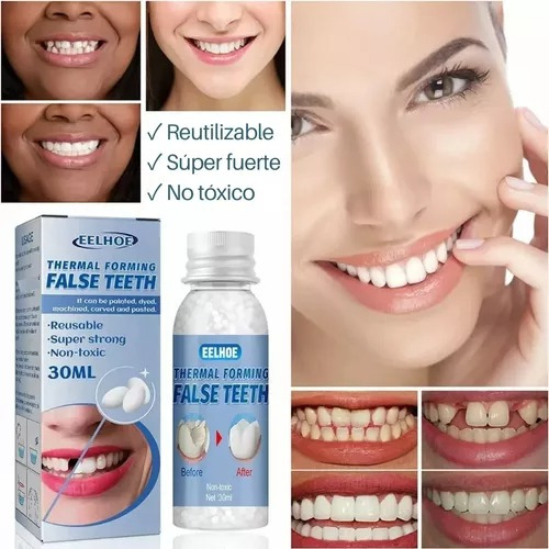 -- Perlas Reparación Dientes Postizos Dientes Gránulos 30ml