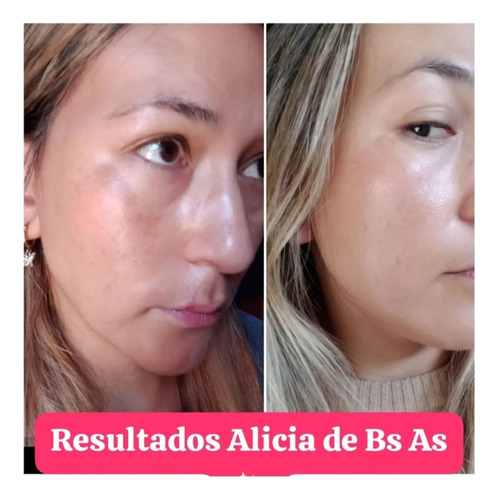 Kit Aclarador Anti Manchas Seytú X2