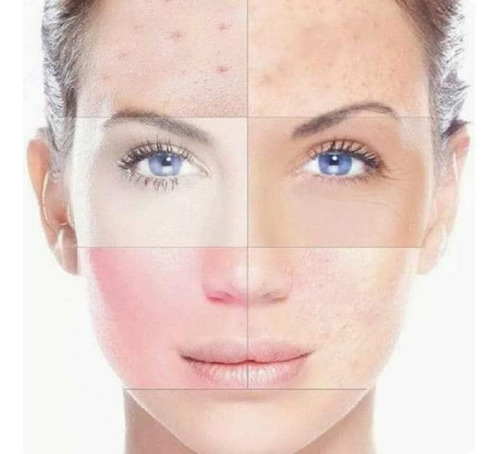 Heblee Crema Aclarante Paño Manchas En 3 Días Vitamina E
