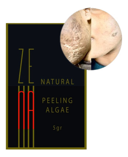 Zena Peeling De Algas 100% Natural Com Anvisa  1 Sachê