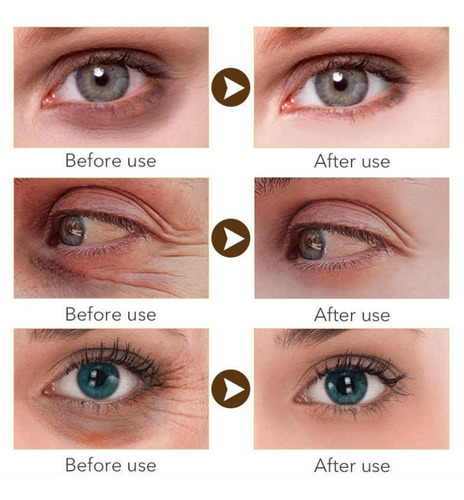 Imagen 6 de 8 de Roll On Ocular Suero Ácido Hialurónico Elasticidad Instante