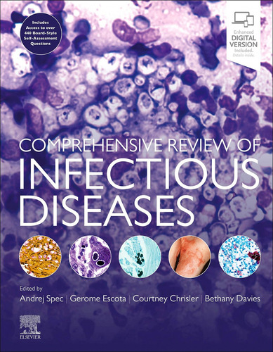 Comprehensive Review Of Infectius Diseases