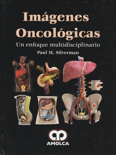 Imagenes Oncologicas Un Enfoque Multidisciplinario 