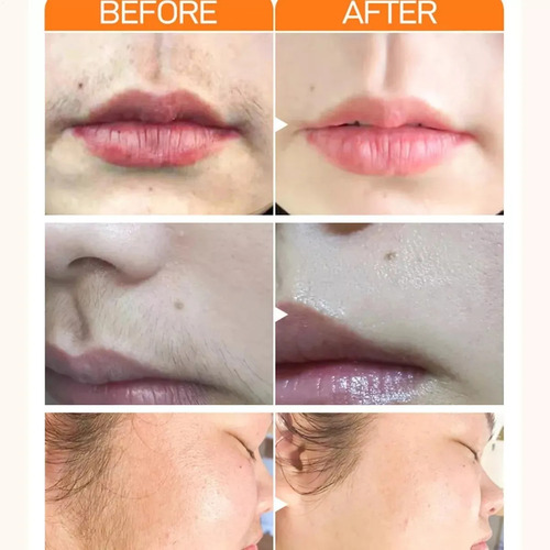 Crema De Depilación Facial, Depilación Del Labio Superior, 1