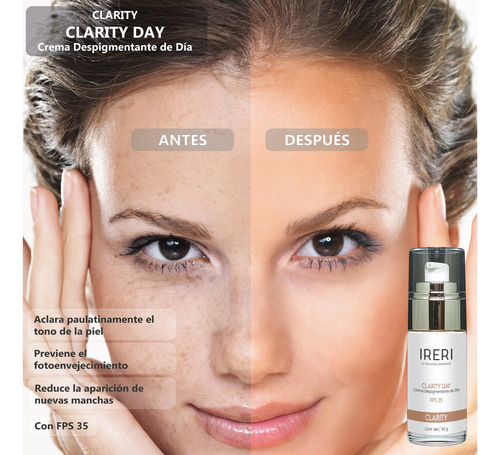 Imagen 3 de 9 de Crema Facial Aclarante Despigmentante Antimanchas De Día Fps 35 Para Todo Tipo De Piel Con Manchas Decolorada Línea Clarity Ireri ®