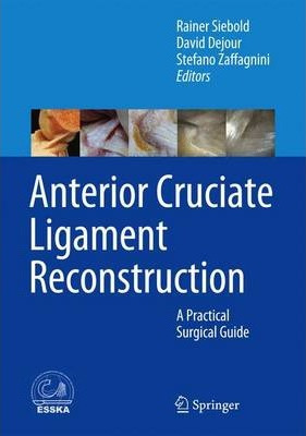Libro Anterior Cruciate Ligament Reconstruction : A Pract...