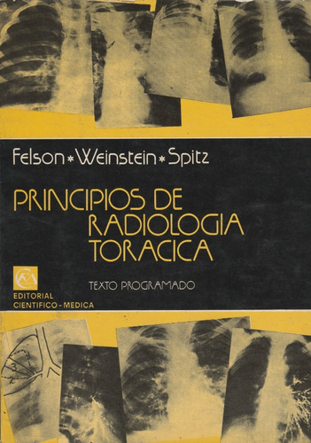 Principios De Radiologia Toracica Felson/weinstein 