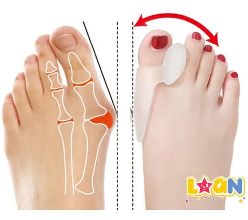 Imagen 3 de 10 de Correctores De Juanetes Con Protector Gel X2 T/valgomed