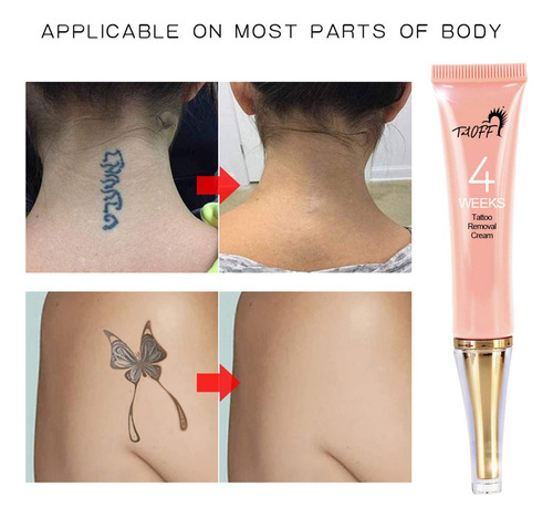 Crema Para Eliminar Tatuajes, Permanente Y Útil, Para Elimin