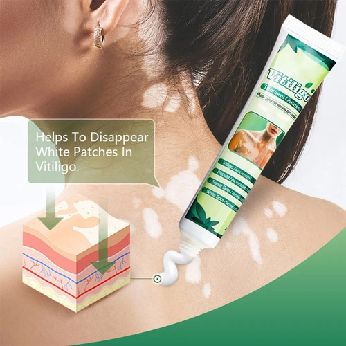 2creme Para Vitiligo, Creme Para Remover Manchas Brancas