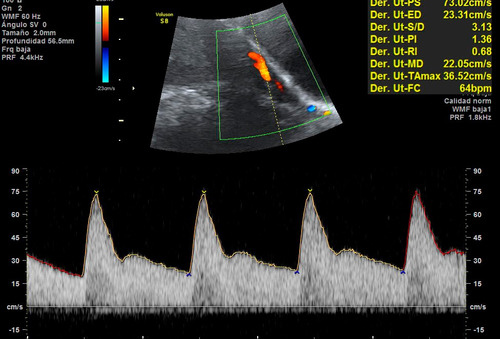 Ecografía Y Ecodoppler Vascular A Domicilio Grales - 5d 4d