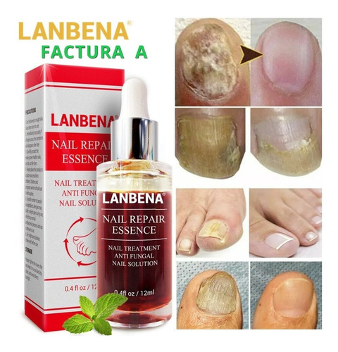 Suero Reparacion Uñas Ataca Hongos Onicomicosis Manos / Pies