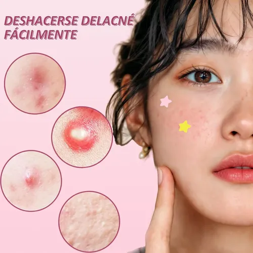 Hx Star Face Estrelas Para Acne Reduz Vermelhidão 96 Yw Cn