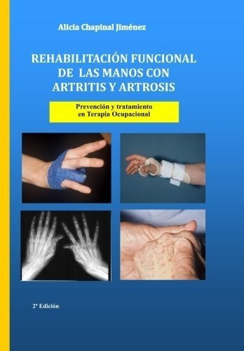 Rehabilitacion Funcional De Las Manos Con Artritis Y Ar&-.