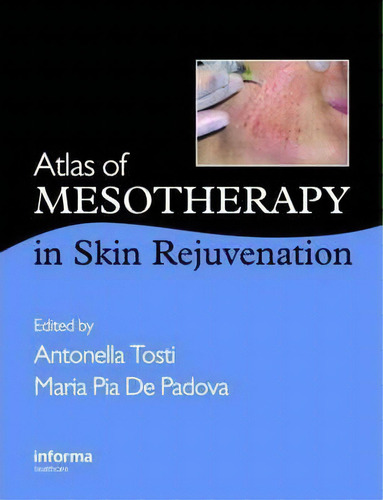 Atlas Of Mesotherapy In Skin Rejuvenation, De Antonella Tosti. Editorial Taylor & Francis Ltd En Inglés