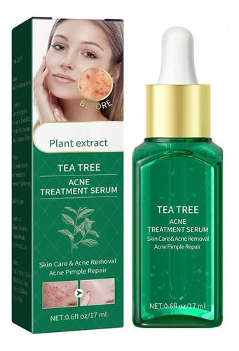 Serum Árbol De Té Anti Acné Piel Grasa Control Poros