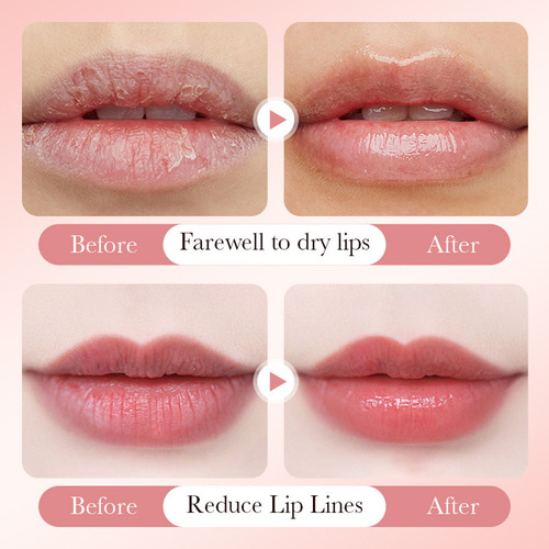 Creme Hidratante Clareador Para Lábios - Lip Mois Seguro E C