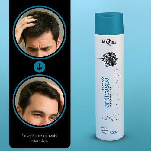 Shampoo Anticaspa Mairibel 300ml - Combate E Previne A Caspa