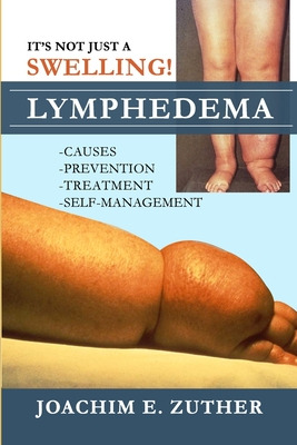 Libro It's Not Just A Swelling! Lymphedema: Causes, Preve...