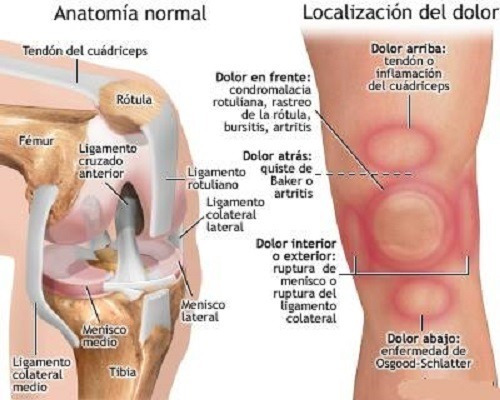 Rodillera Ortopédico Velcro Estabilizador 3 Ajustes Neopreno