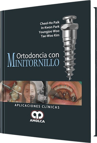 Ortodoncia Con Minitornillo Paik