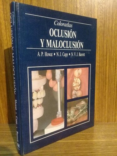 Atlas Color De Oclusión Y Maloclusión - Howat (1992, Mosby)