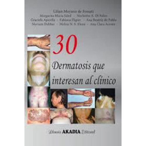 30 Dermatosis Que Interesan Al Clínico