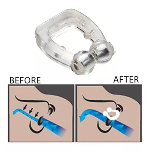 Clip nasal magnetico para dejar de roncar - Shop online - Alfadinamica
