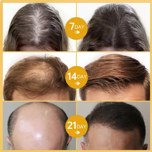 Mielle Aceite Fortalecedor Ligero Para Cabello Romero Ymenta