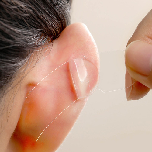 Pegatinas De Soporte Para Orejas De Elfo, Corrector De Oreja