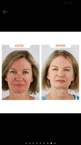 Imagem 4 de 5 de Revitalize Hialuronic Caps - Ácido Hialurônico Americano + C