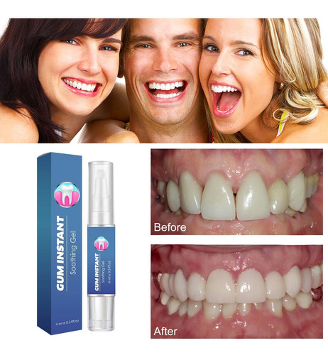 Um Gel De Creme Dental Melhora A Saúde Bucal E Reduz O Sensi