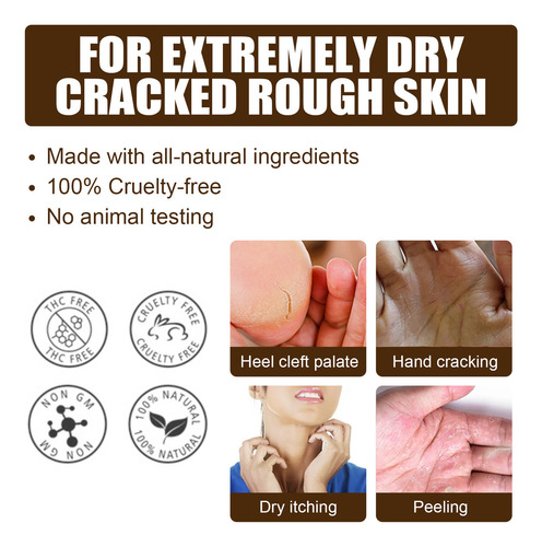 Crema Reparadora K Skin Repair Skin Repara La Piel Agrietada