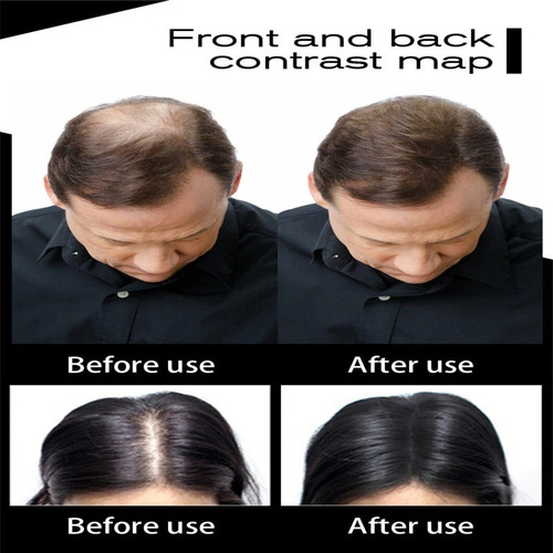 Imagen 4 de 7 de Toppik Fibras Capilares Cabello Negro Instantáneo P/calvicie