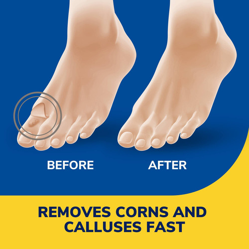 Eliminador Líquido De Maíz Y Callos Dr. Scholl's, 10 Ml, Con