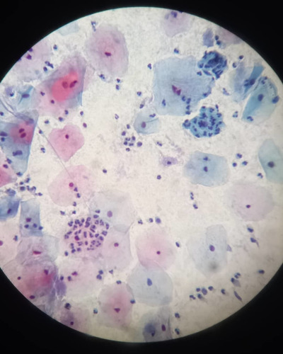 Imagen 2 de 6 de Harris Hematoxilin_a