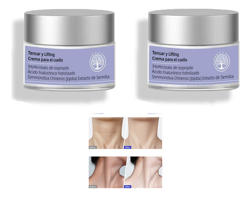 2025 Última Weud Crema Para El Cuello - ¡reafirma 2pcs