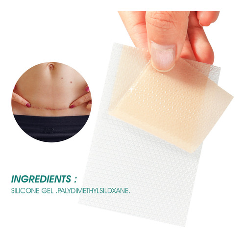 Parche En Forma De T Para Cicatrices De Cesárea (4 Parches)