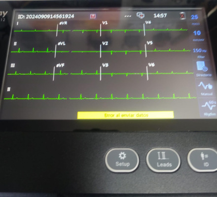 Cardiografo Mindray Beneheart R12