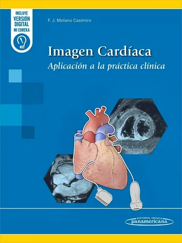 Molano - Imagen Cardíaca
