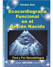 Ecocardiografia Funcional En El Recien Nacido - Osio, Cristi